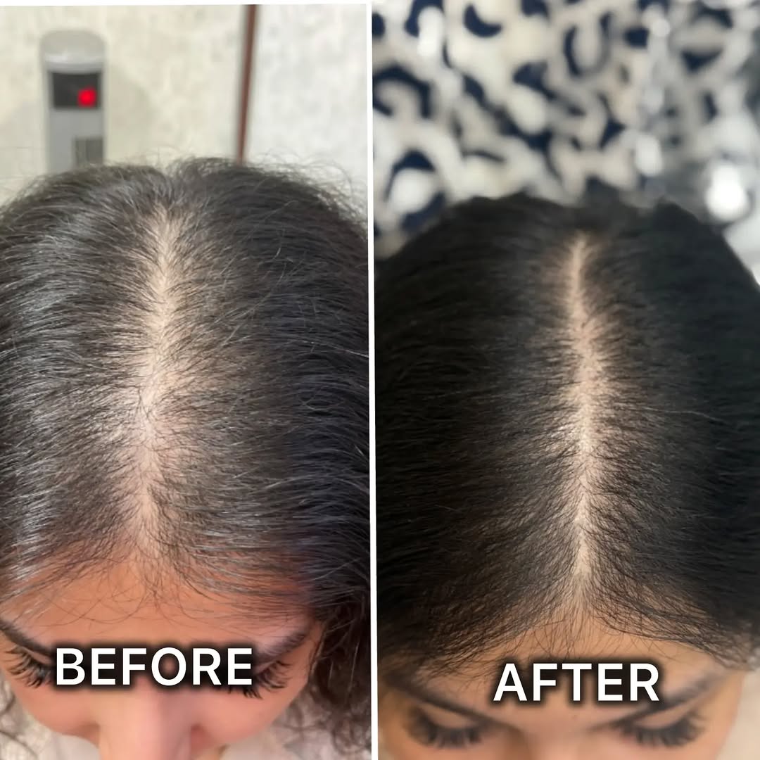 Success Story 2